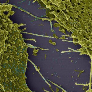 Imagens obtidas pela Fiocruz e Inmetro mostram coronavírus em ação