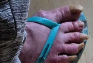 Ex-atriz da Globo: resgate no RS expõe abandono e vulnerabilidade