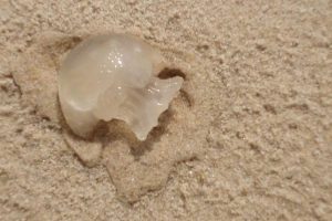 Torres, Queimaduras por águas-vivas